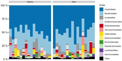 A Changed Gut Microbiota Diversity Is Associated With Metabolic Improvements After Duodenal Mucosal Resurfacing With Glucagon-Like-Peptide-1 Receptor Agonist in Type 2 Diabetes in a Pilot Study